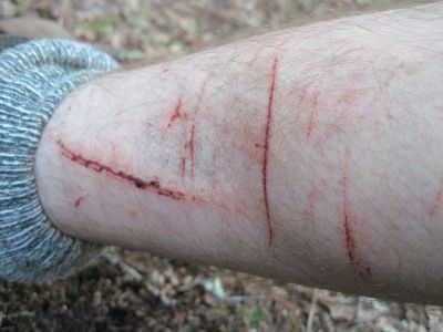 Rough Trails...
cuts, bruises...
4-10
